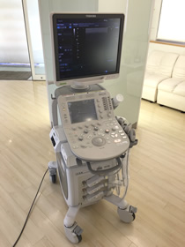 超音波検査装置